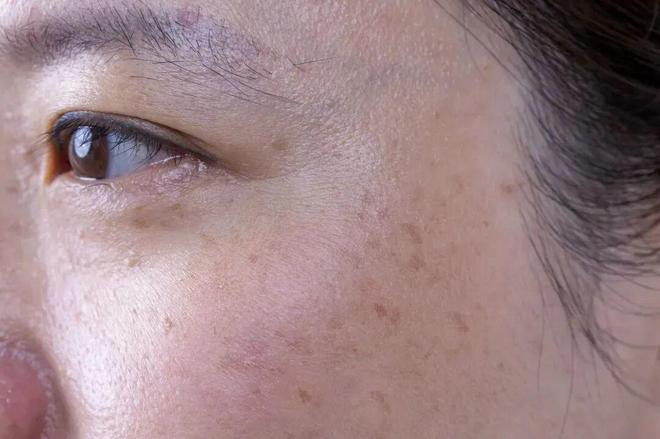 道我在雪场被晒得很曼妙pg电子中国网站不知(图12)